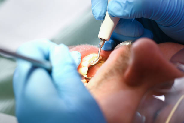 Best Walk-In Emergency Dentist in Whittingham, NJ